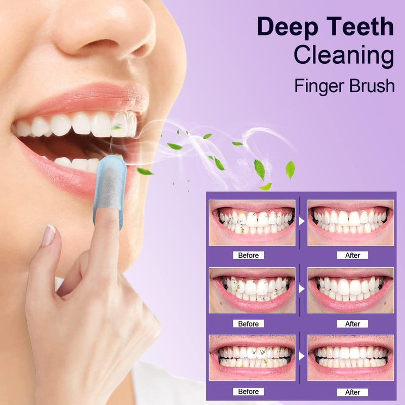 MySmile Deep Cleaning Teeth Wipes for Tooth Cleaner Teeth Wipes Thistle