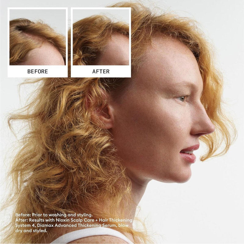 Nioxin Nioxin Density System 4 Scalp Therapy Conditioner (Colored Hair, Progressed Thinning, Color Safe) 1000ml/33.8oz Shampoo & Conditioner White Smoke