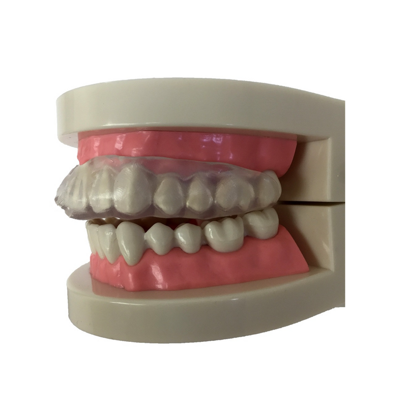 Archtek Archtek Grind Guard Dental Tray With 3 Inches Mirrored Case Health & Beauty White Smoke