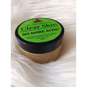 KaziRokz Organic Matcha Green Tea + Aloe Vera Acne Treatment/ Clear Skin Treatment (100% Vegan/CrueltyFree) 4oz Light Gray