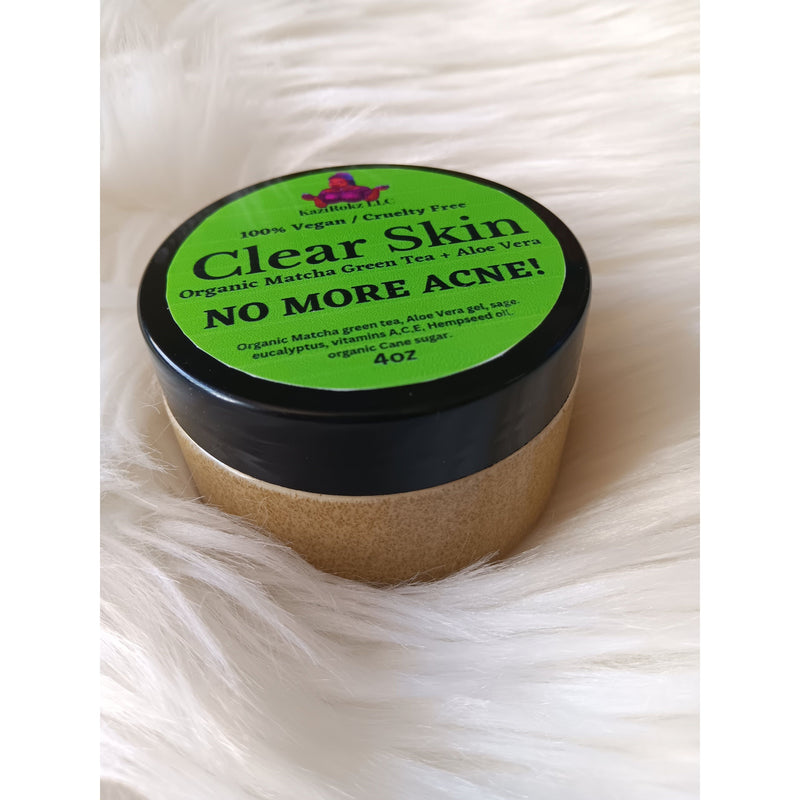KaziRokz Organic Matcha Green Tea + Aloe Vera Acne Treatment/ Clear Skin Treatment (100% Vegan/CrueltyFree) 4oz Light Gray
