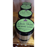 KaziRokz Organic Matcha Green Tea + Aloe Vera Acne Treatment/ Clear Skin Treatment (100% Vegan/CrueltyFree) 4oz Dim Gray