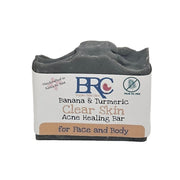 By Robin Creations Clear Skin Essential Acne Healing Facial Bundle with Free Healing Cleansing Bar Acne Treatments & Kits Gray Original Scent (Clarifying Peppermint & Lemon Essential Oils),Unscented