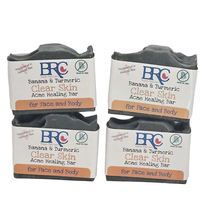 By Robin Creations Clear Skin Acne Blasting Face & Body Soap with Banana & Turmeric Acne Treatments & Kits White Smoke 4 Bars