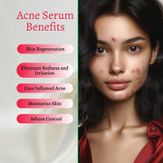 gymsegbë New Skin Natural Intensive Acne Serum Acne Treatments & Kits Light Gray 1 Bottle,2 Bottles Save $4,3 Bottles Save $9