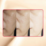 gymsegbë Thick As Thieves Pure Glycolic Acid Lactic Acid Extreme Gel Peel - 50ml Exfoliation, Dark Spots, Hyperpigmentation Antique White 1 BottleSave 6.90,2 Bottles Save $9.99,3 bottles Save $12.98,4 Bottles Save $24.97