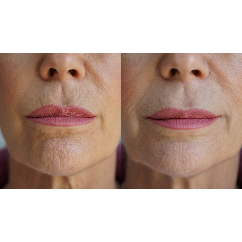 PRAI Beauty Ageless Lip & Line Filler Ageless Problem Solver Dark Olive Green Single Tube - 8mL,2 Pack