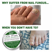 COLEHERBALS LLC 12 - Dr. Cole's Nail Fungus Balm Herbal White Smoke
