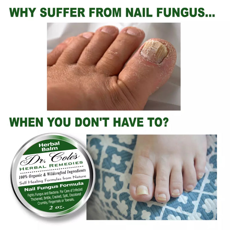 COLEHERBALS LLC 12 - Dr. Cole's Nail Fungus Balm Herbal White Smoke