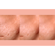 gymsegbë Ultra-Advanced Anti-Aging Daily Resurfacing Pads skincare Light Salmon 1 Jar,2 Jars Save $2.99,3 Jars Save $3.98,4 Jars Save $12.97