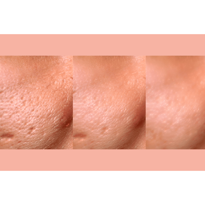 gymsegbë Ultra-Advanced Anti-Aging Daily Resurfacing Pads skincare Light Salmon 1 Jar,2 Jars Save $2.99,3 Jars Save $3.98,4 Jars Save $12.97