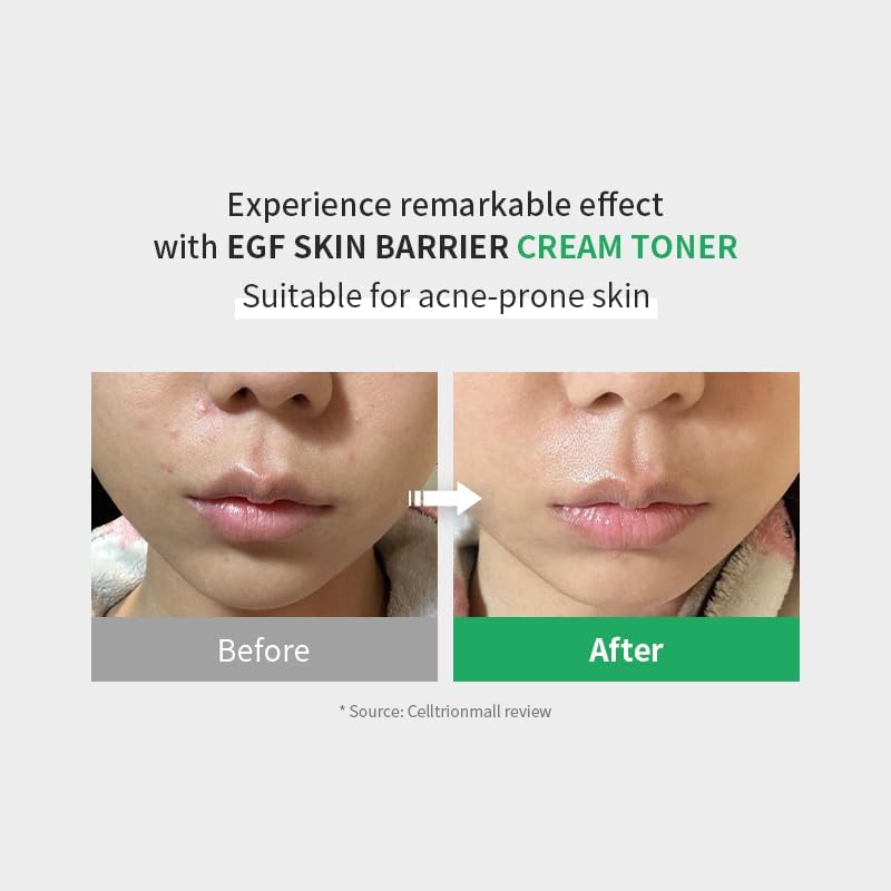 AsiaBeautyMall Z+PIDERM ECF Skin Barrier Cream Toner Toner Lotion Lavender