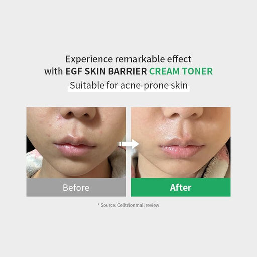 AsiaBeautyMall Z+PIDERM ECF Skin Barrier Cream Toner Toner Lotion Lavender