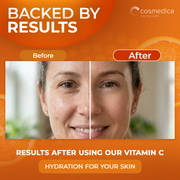 Cosmedica Skincare Cosmedica Skincare Vitamin C Serum for Face with Hyaluronic Acid – Anti Aging Serum for Dark Spots, Fine Lines, Wrinkles – Hydrating Collagen Booster for Women & Men Serum Chocolate 1oz,2oz