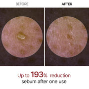 AsiaBeautyMall Dr. Melaxin Peel Shot Exfoliant Black Rice Ampoule Face Cleanser White Smoke