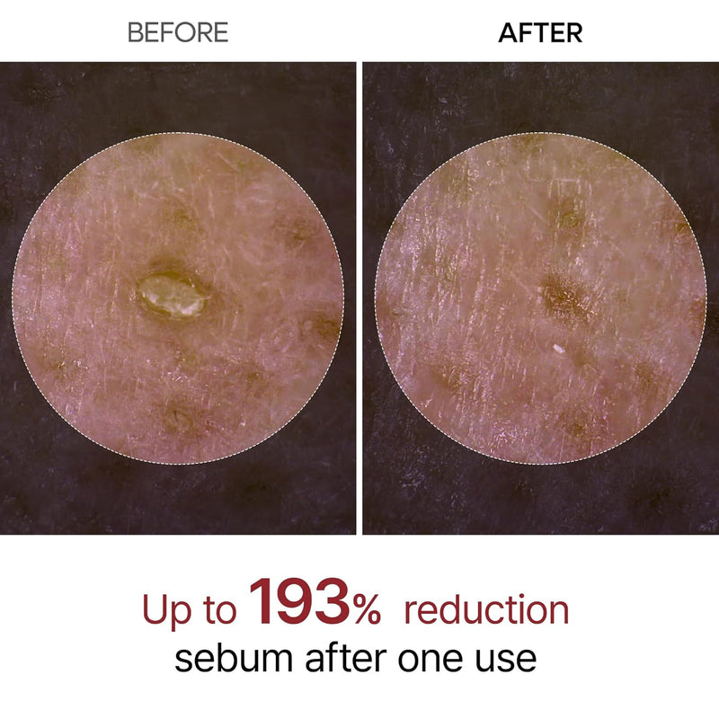 AsiaBeautyMall Dr. Melaxin Peel Shot Exfoliant Black Rice Ampoule Face Cleanser White Smoke