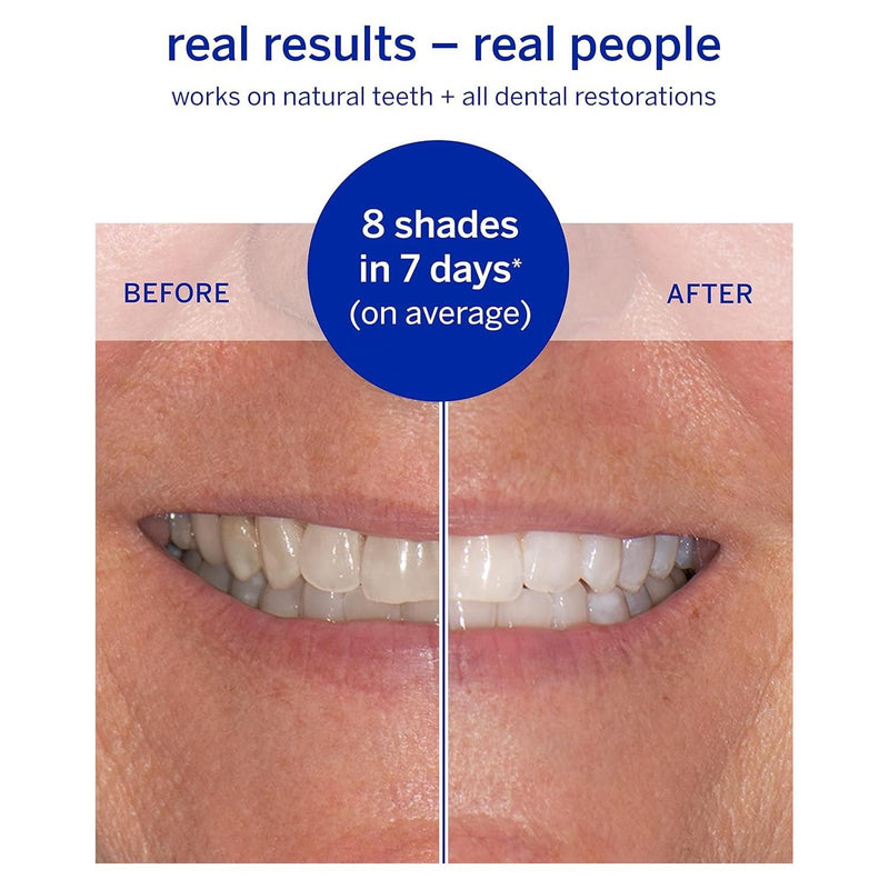 supersmile Supersmile Superstrips Teeth Whitening Dissolving Strips 14 Teeth Whitening Rosy Brown