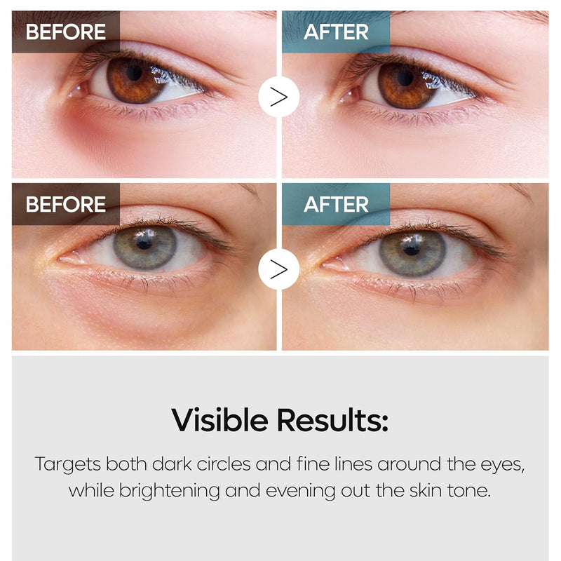 AsiaBeautyMall Dr. Melaxin TX Retinalsome Double Effect Eye Cream Eye Cream Lavender