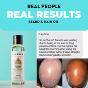 Lizzie's All-natural Products Beard & Hair Oil Sky Blue Patchouli Mint,Peppermint