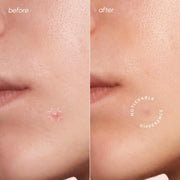 Maree Invisible Pimple & Acne Patches Build Your Bundle Light Pink