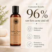 Timeless Organics Skin Care Clarifying Acne Cleanser Cleanser Misty Rose