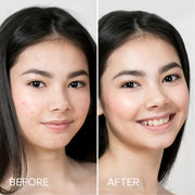 Maree Pimple & Acne Patches Wheat 1 item - Complete your routine,2 items - Good choice,3 items - Best price