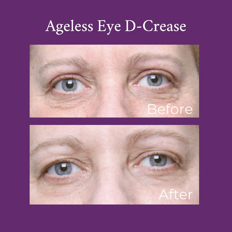 PRAI Beauty Ageless Eye D-Crease Ageless Problem Solver Thistle 0.5oz/15ml