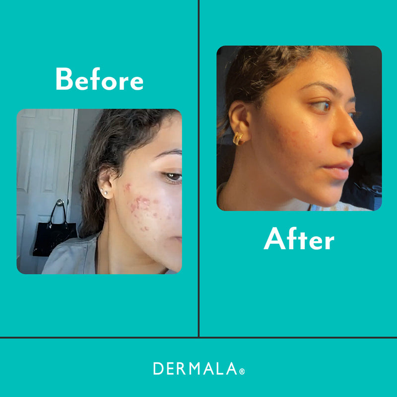 DERMALA SUPPLEMEANT to Be® - DIM Skin Mix Rosy Brown