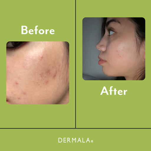 DERMALA SCANTILY Pad® Dark Khaki 00860475001120,00860475001144,00860475001168