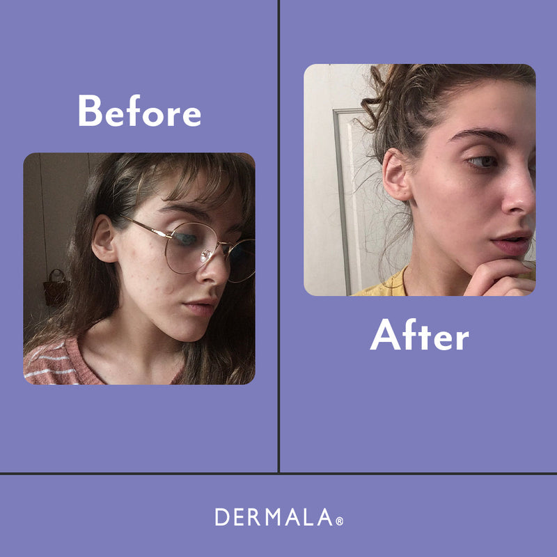 DERMALA SUPPLEMEANT to Be® Pre+Probiotic+Vitamin Skin Mix Light Slate Gray