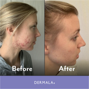 DERMALA SUPPLEMEANT to Be® Pre+Probiotic+Vitamin Skin Mix Dim Gray