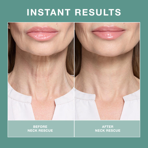 Contours Rx Neck Rescue Neck Firming Treatment Light Pink 1 Pack,2 Packs,3 Packs