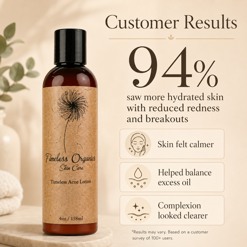 Timeless Organics Skin Care Clarifying Acne Lotion Lotion Antique White