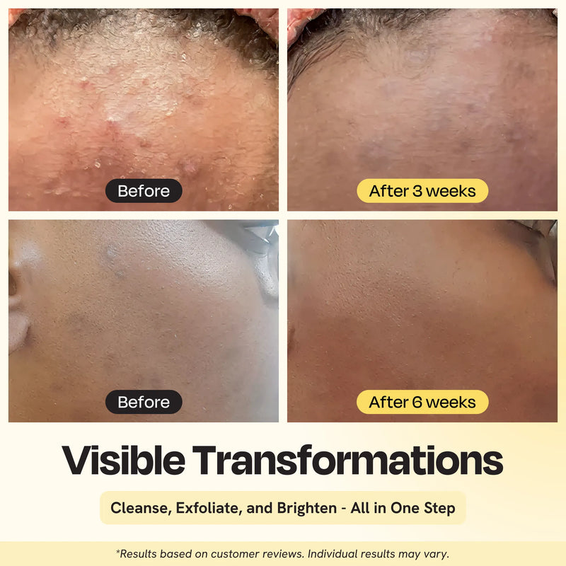 Gleamin Clarifying Brightening Cleanser Facial Cleanser Seashell