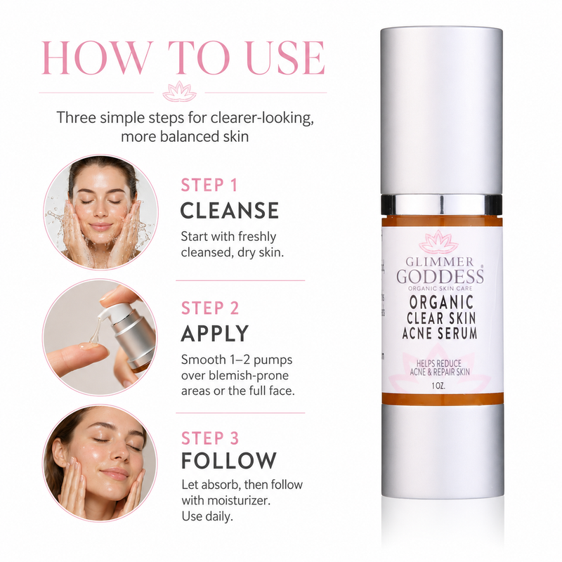 Glimmer Goddess® Organic Skin Care Organic Acne Serum – Oil Control & Pore Clearing Treatment Serums White Smoke 1 oz