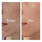 Geologie Clear System Face Routine Rosy Brown