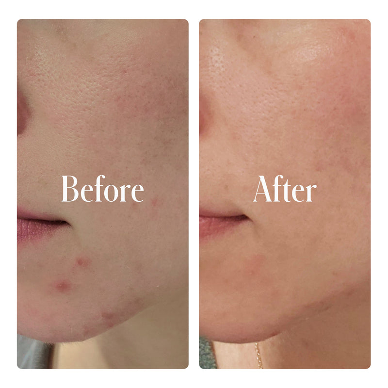 Geologie Clear System Face Routine Rosy Brown