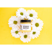 Lizzie's All-natural Products Lizzies All Natural Eczema Butter Light Goldenrod Original-Unscented / 2 ounce travel size,Lavender-Chamomile / 2 ounce travel size,Original-Unscented / 4 ounce,Original-Unscented / 8 ounce,Lavender-Chamomile / 4 ounce,Eucalyptus-Chamomile / 4 ounce,For Babies / 4 ounce