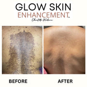 Glow Skin Enhancement ECZEMA RELIEF PACKAGE (Real Results) Eczema Care Rosy Brown