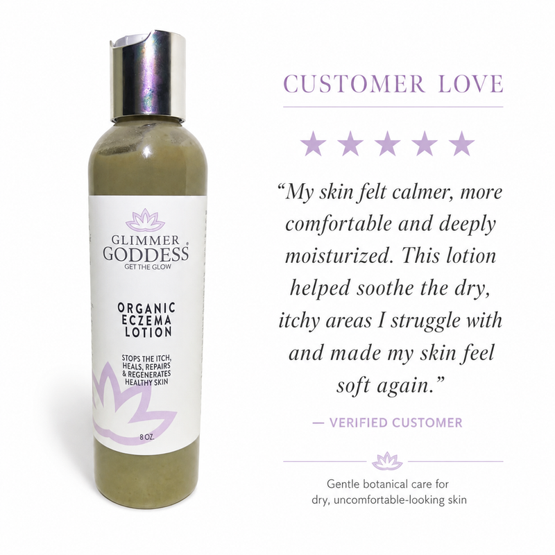 Glimmer Goddess® Organic Skin Care Organic Eczema Lotion – Soothing Relief & Skin Healing Lotions & Creams White Smoke 8 oz,4 oz,2 oz