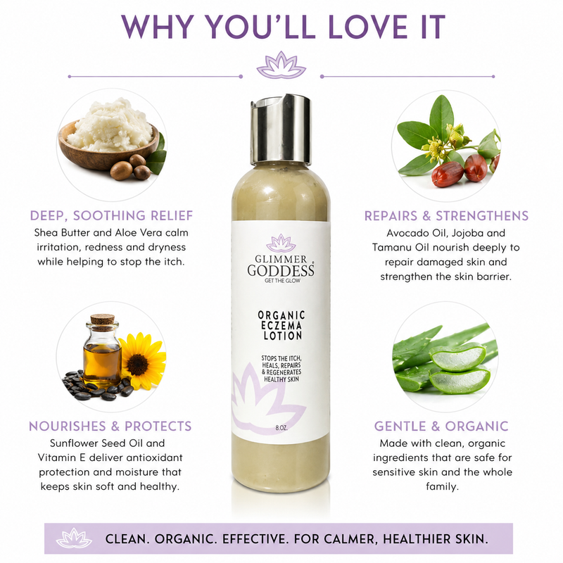 Glimmer Goddess® Organic Skin Care Organic Eczema Lotion – Soothing Relief & Skin Healing Lotions & Creams White Smoke 8 oz,4 oz,2 oz