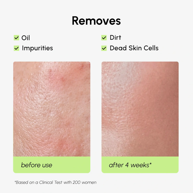 Maree Daily Glow Exfoliating Toner White Smoke 1 item - Complete your routine,2 items - Good choice,3 items - Best price
