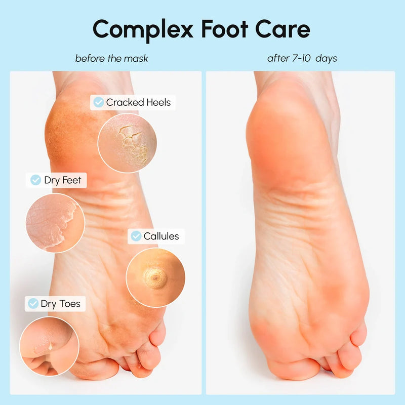 Maree Exfoliating & Hydrating Foot Mask White Smoke 1 item - Complete your routine,2 items - Good choice,3 items - Best price