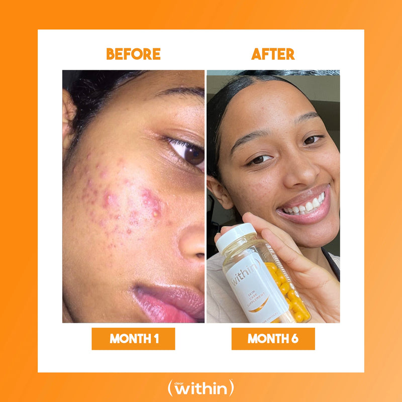 Clear Within Clear Skin Vitamin Sandy Brown