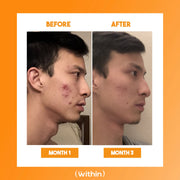 Clear Within Clear Skin Vitamin Coral