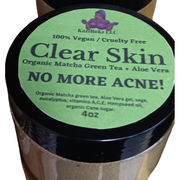 KaziRokz Organic Matcha Green Tea + Aloe Vera Acne Treatment/ Clear Skin Treatment (100% Vegan/CrueltyFree) 4oz Dark Slate Gray