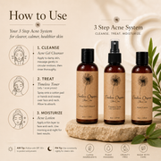 Timeless Organics Skin Care 3-Step Acne System Kit Antique White Gel,Foaming