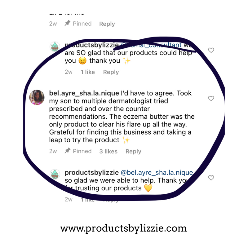 Lizzie's All-natural Products Lizzies All Natural Eczema Butter White Smoke Original-Unscented / 2 ounce travel size,Lavender-Chamomile / 2 ounce travel size,Original-Unscented / 4 ounce,Original-Unscented / 8 ounce,Lavender-Chamomile / 4 ounce,Eucalyptus-Chamomile / 4 ounce,For Babies / 4 ounce