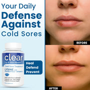Clear Wellness 360 Lysine + Probiotic Supplement for Cold Sore Support | Lip & Skin Health + Immune Support Probiotics Plus Alice Blue 3 Pack,1 Bottle,6 Pack