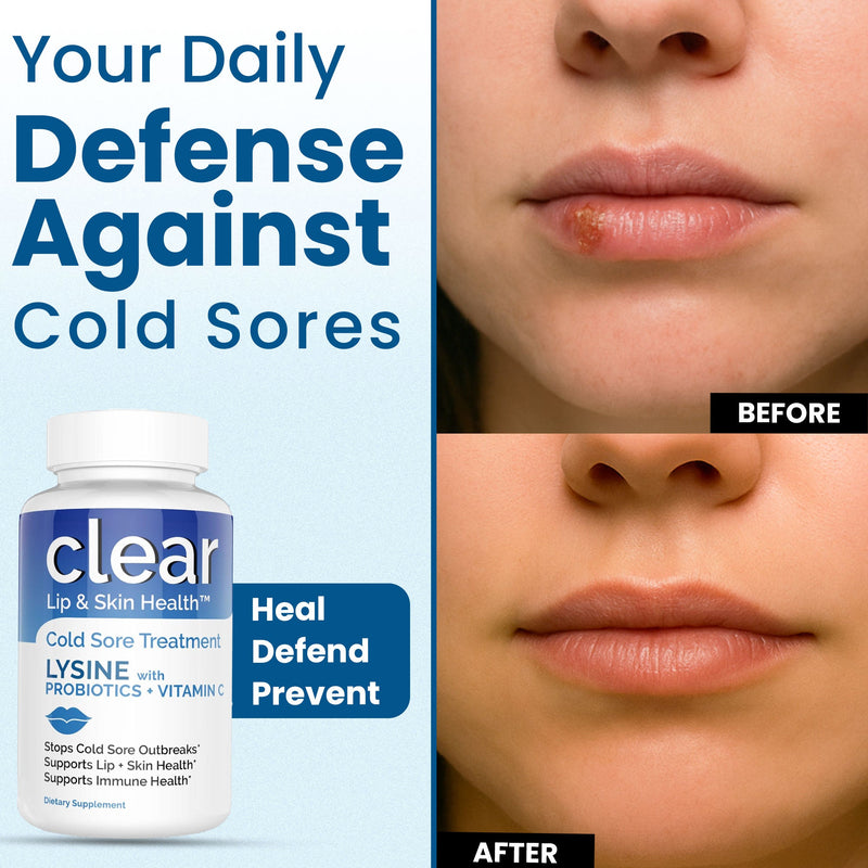Clear Wellness 360 Lysine + Probiotic Supplement for Cold Sore Support | Lip & Skin Health + Immune Support Probiotics Plus Alice Blue 3 Pack,1 Bottle,6 Pack